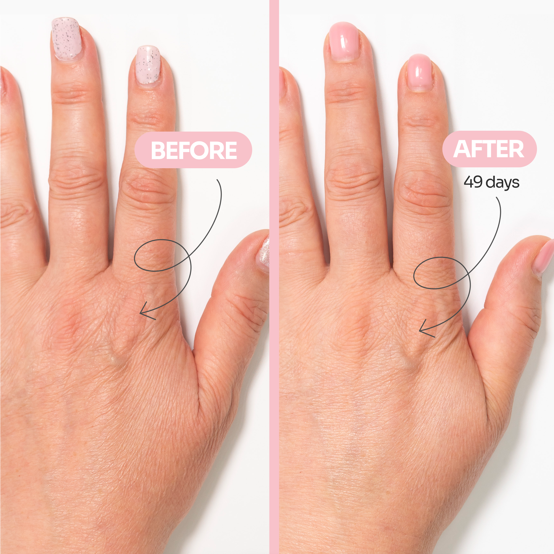 AGE-DEFYING hand cream