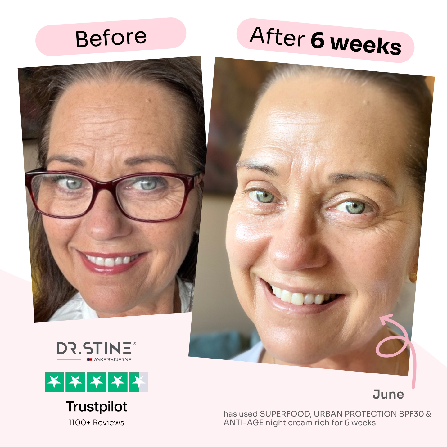Trial size: #1 Best Seller - The 4-in-1 Skin Transformer: SUPERFOOD